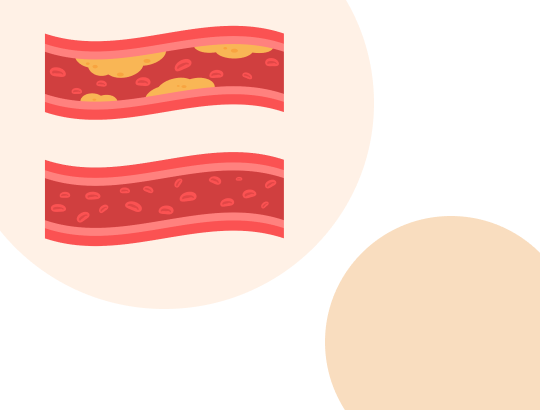 Новый калькулятор «Индекс атерогенности»